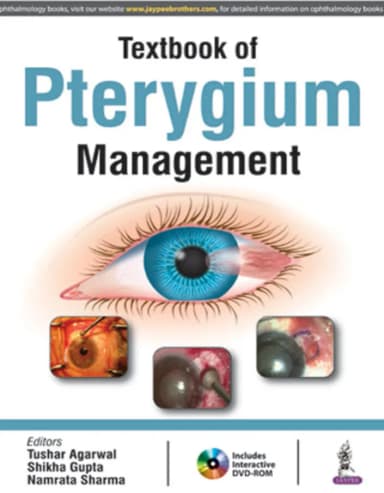 Image of - Textbook of Pterygium Management with Dvd-rom - 1st Edition