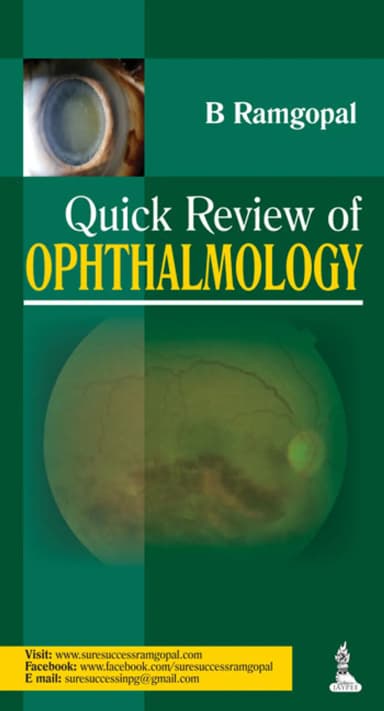 Image of - Quick Review of Ophthalmology