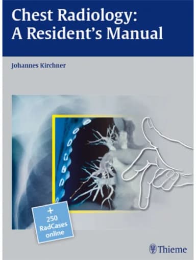 Image of - Radcases Chest Radiology A Residents Manual - 1st Edition
