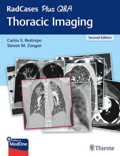 Image of - RadCases Plus Q&A Thoracic Imaging: 2/e