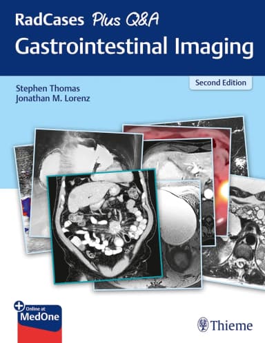 Image of - RadCases Plus Q&A Gastrointestinal Imaging 2nd Ed