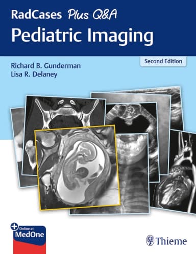Image of - RadCases Plus Q&A Pediatric Imaging 2nd Ed.