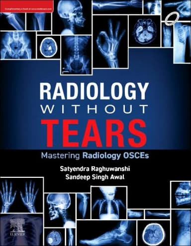 Image of - Radiology Without Tears
