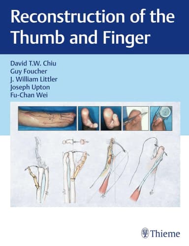 Image of - Reconstruction of the Thumb and Finger 1st Edition