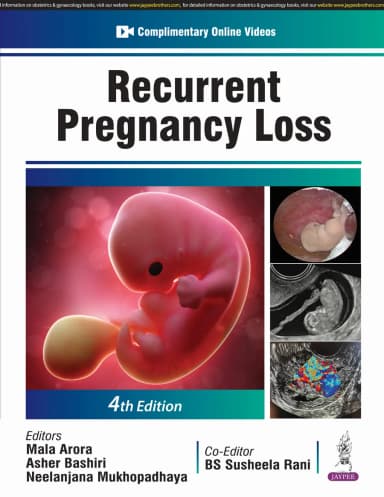 Image of - Recurrent Pregnancy Loss