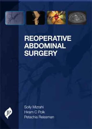 Image of - Reoperative Abdominal Surgery