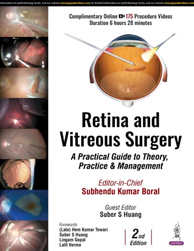 Image of - Retina & Vitreous SurgeryâA Practical Guide to Theory, Practice and Management