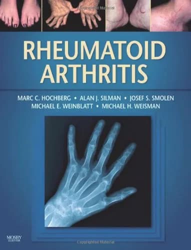 Image of - Rheumatoid Arthritis