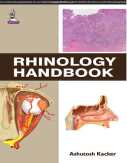rhinology-handbook-1st-edition