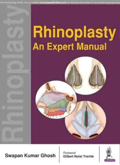 Image of - Rhinoplasty Expert Manual - 1st Edition