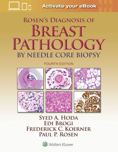 Image of - Rosen's Diagnosis of Breast Pathology by Needle Core Biopsy - 4th Edition