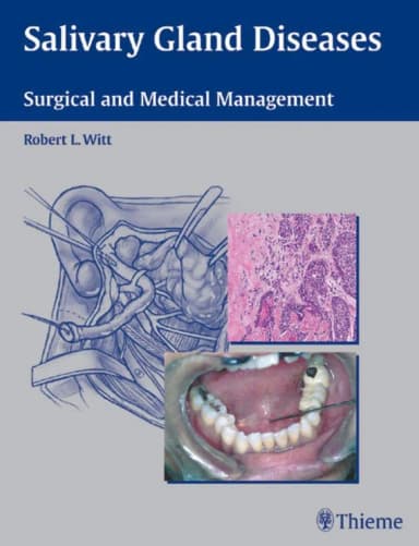 Image of - Salivary Gland Diseases