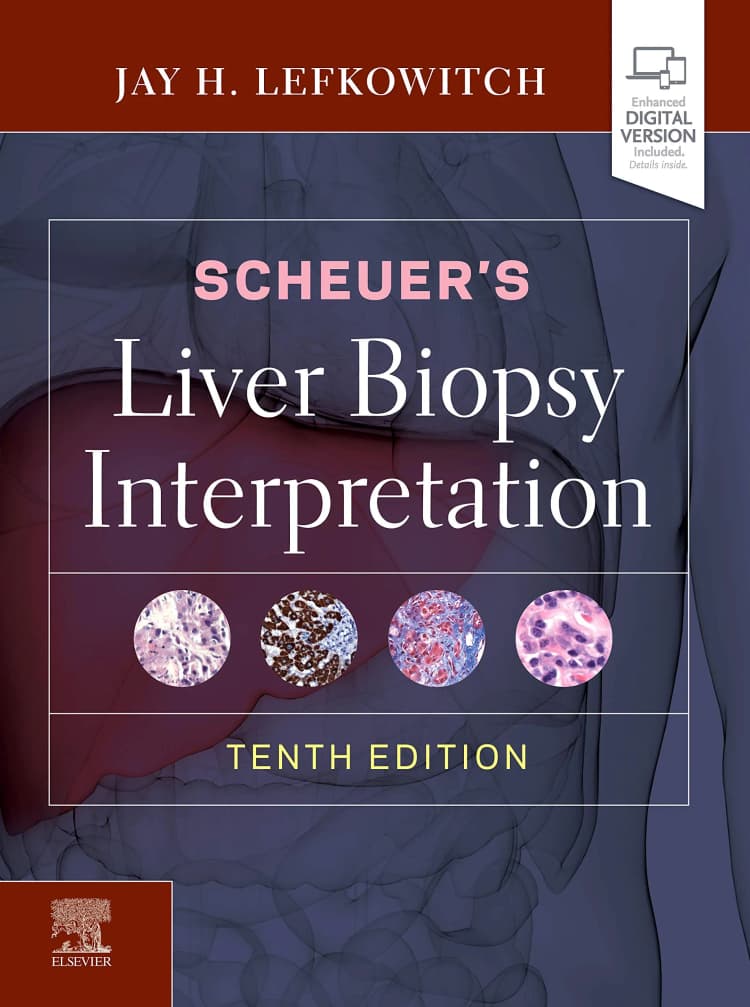 Scheuer's Liver Biopsy Interpretation - 10th Edition 
