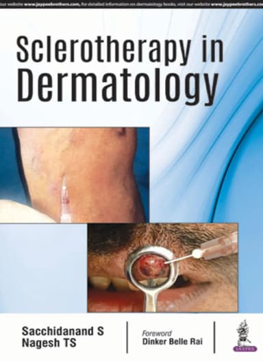 Image of - Sclerotherapy in Dermatology