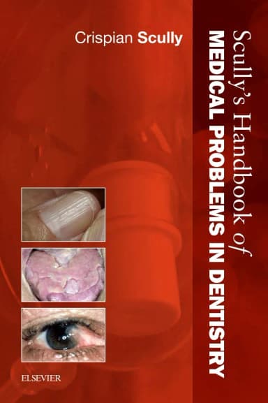 Image of - Scullys Handbook of Medical Problems in Dentistry - 1st Edition