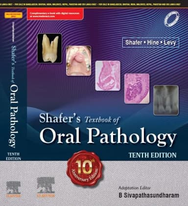 Image of - Shafer's Textbook Of Oral Pathology - 10E