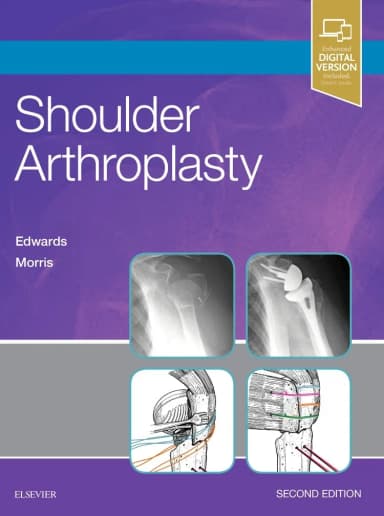 Image of - Shoulder Arthroplasty -2E