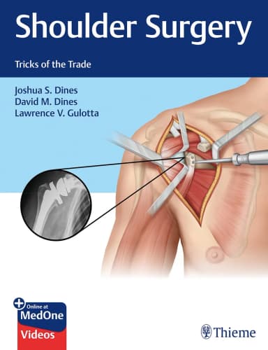 Image of - Shoulder Surgery Tricks of the Trade 1st Ed.