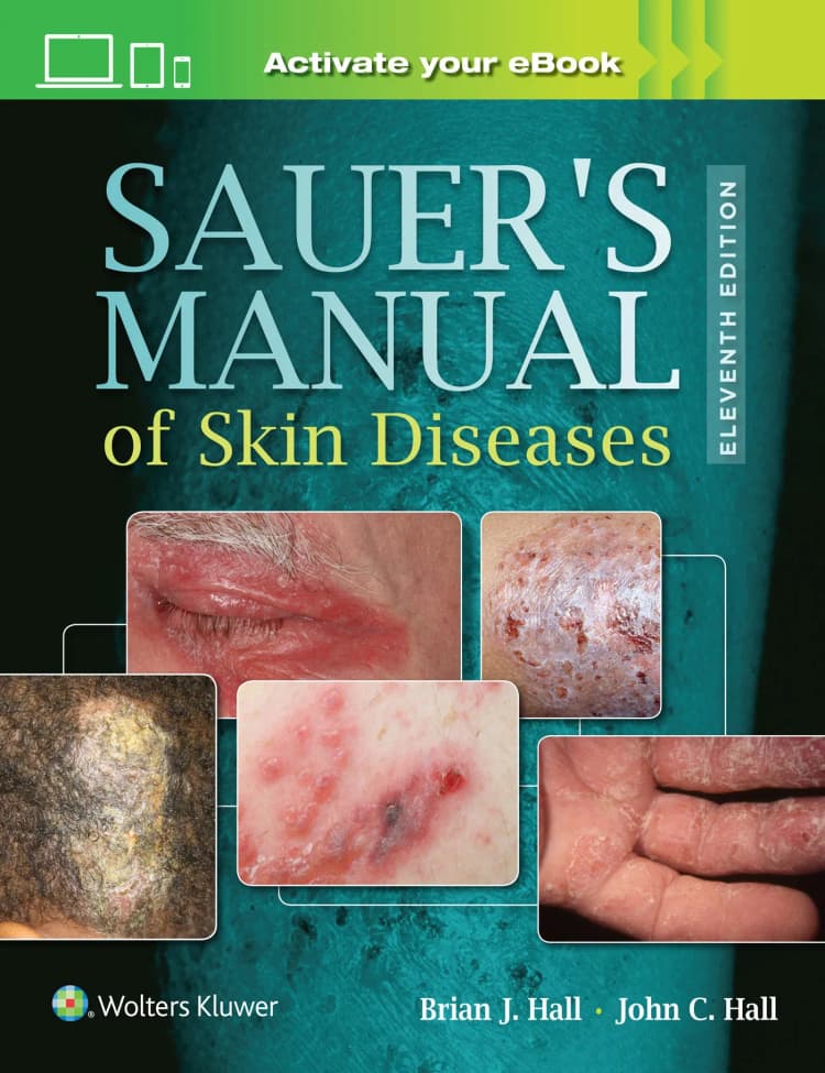 Sauer's Manual of Skin Diseases - 11th Edition