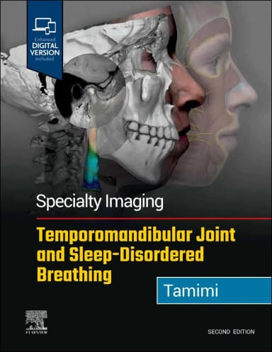Image of - Specialty Imaging: Temporomandibular Joint and Sleep-Disordered Breathing-2E