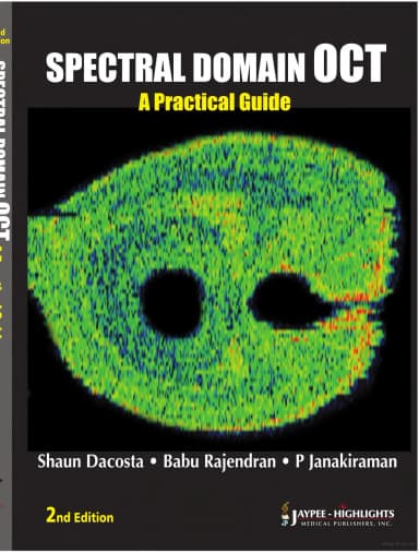 Thumbnail - Spectral Domain Oct Practical Guide - 2nd Edition
