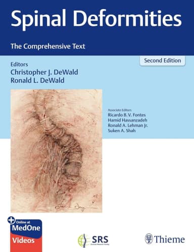Image of - Spinal Deformities : The Comprehensive Text, 2nd Edition