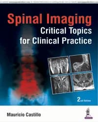 Image of - SPINAL IMAGING CRITICAL TOPICS FOR CLINICAL PRACTICE