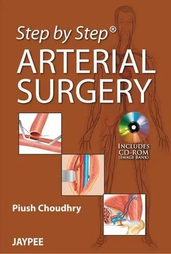 Image of - STEP BY STEP ARTERIAL SURGERY WITH CD-ROM