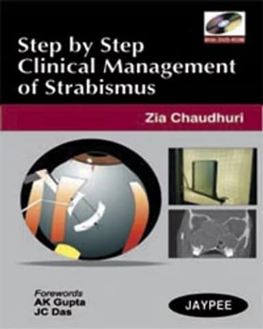 Image of - Step by Step Clinical Management of Strabismus (with DVD-ROM)