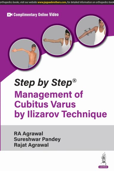 Image of - Step by Step Management of Cubitus Varus by Ilizarov Technique