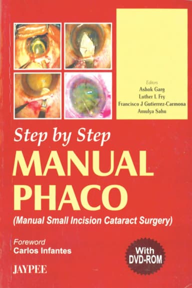 Image of - Step By Step Manual Phaco with Dvd-rom - 1st Edition