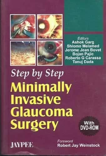 Step By Step Minimally Invasive Glaucoma Surgery with Dvd-rom - 1st Edition