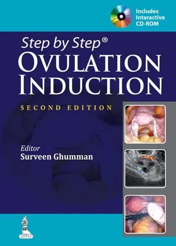 Image of - Step By Step Ovulation Induction with Cd-rom - 2nd Edition