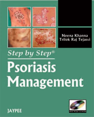 Image of - Step by Step Psoriasis Management