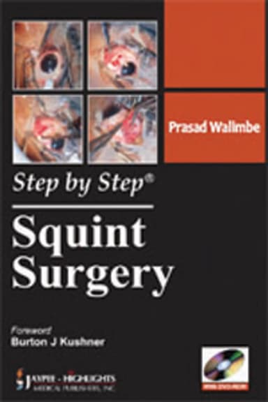 Image of - Step by Step Squint Surgery