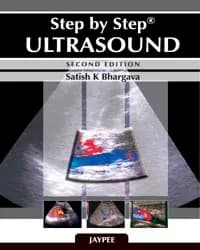 Image of - STEP BY STEP ULTRASOUND