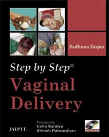Image of - Step by Step Vaginal Delivery (With DVD Rom)