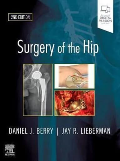 Image of - Surgery of the Hip: Expert Consult - Online and Print - 2E