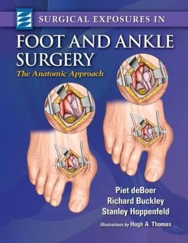 Thumbnail - Surgical Exposures in Foot and Ankle Surgery - 1st Edition