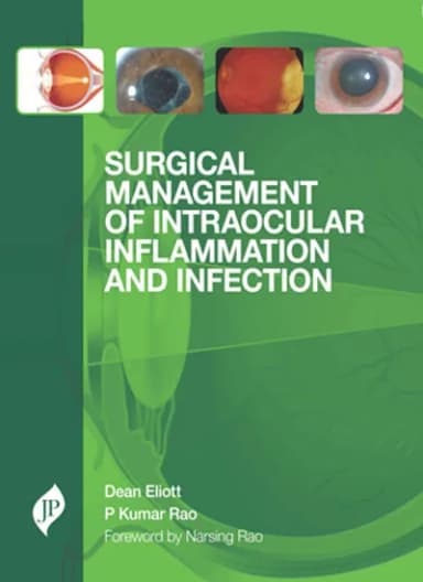 Image of - Surgical Management of Intraocular Inflammation and Infection - 1st Edition