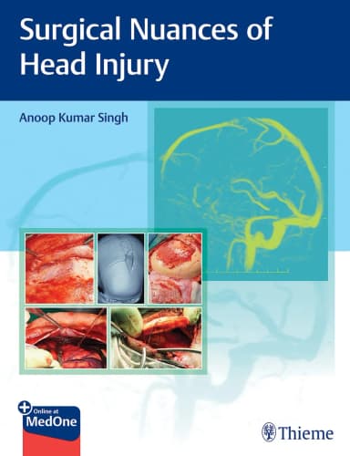 Image of - Surgical Nuances Of Head Injury 1st Ed.