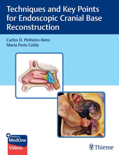 Image of - Techniques and Key Points for Endoscopic Cranial Base Reconstruction 1st Ed.