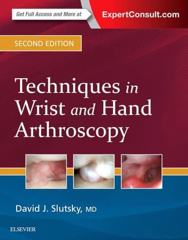 Image of - Techniques in Wrist and Hand Arthroscopy -2E