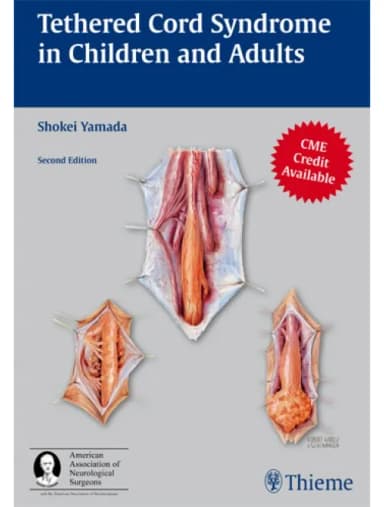 Thumbnail - Tethered Cord Syndrome in Children and Adults - 2nd Edition