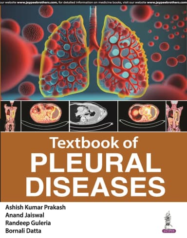 Image of - Textbook of Pleural Diseases