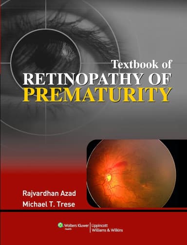 Image of - T.B of Retinopathy of Prematurity