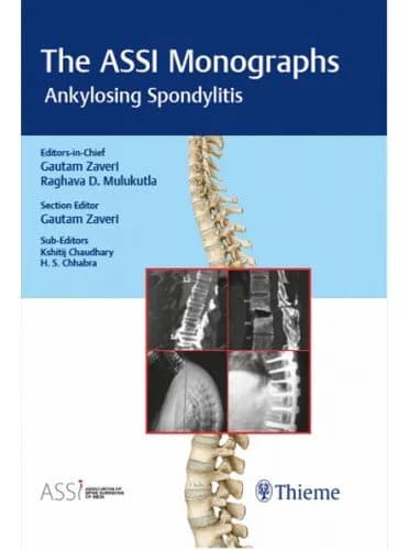Image of - The ASSI Monographs-Ankylosing Spondylitis