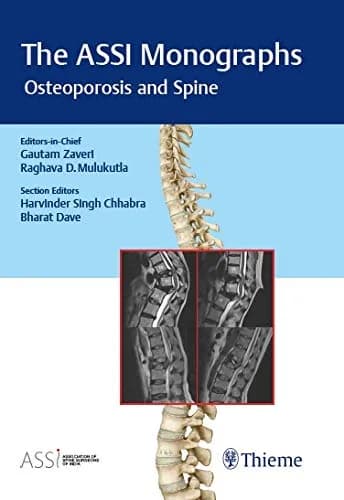 Image of - The ASSI Monographs - Osteoporosis and Spine