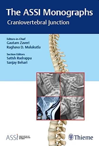 Image of - The ASSI Monographs—Craniovertebral Junction