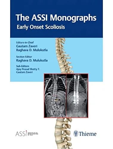 Image of - The ASSI Monographs—Early Onset Scoliosis